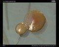 pseudomonas aeruginosa colony
